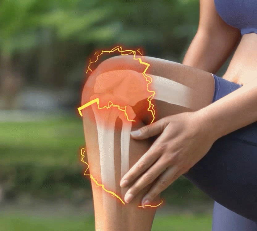 Dolor articular